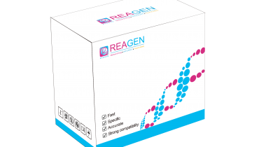 對蝦黃頭病毒（YHV）RNA恒溫核酸檢測試劑盒（不含提?。? />
                            </a>
                        </div>
                                            </div>
                </div>
                <div   id="dzc4j63"   class="col-lg-5">
                    <div   id="4gmu9a4"   class="product-intro">
                        <h1 class=